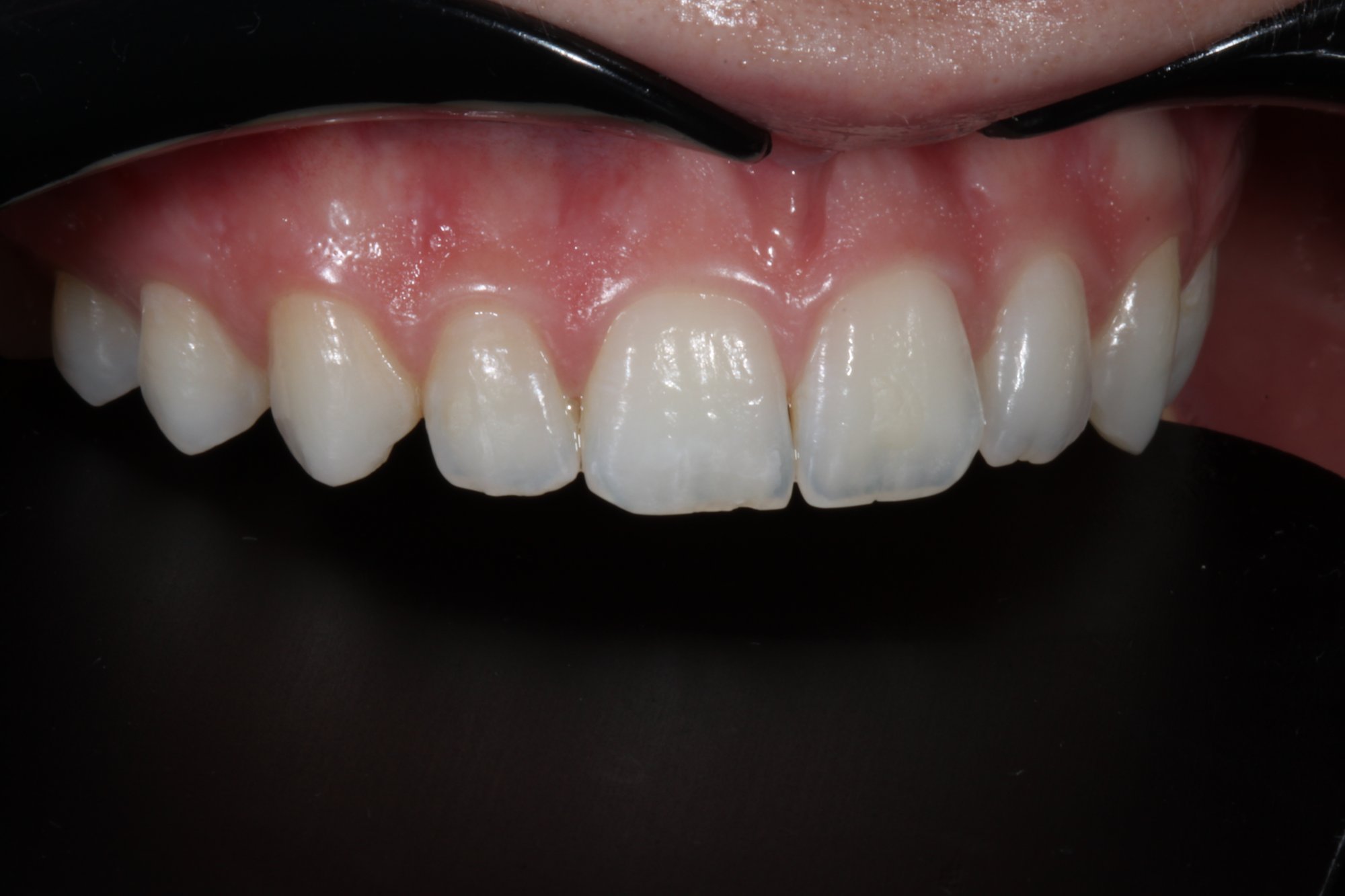 Anatomie des Zahnes 12. Anatomie des Zahnes 12.