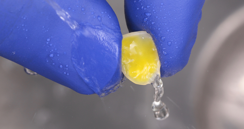 Prozess bei einer dentalen Veneer Behandlung