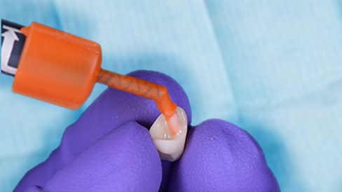 3M™ RelyX™ Universal Mikro-Mischkanüle 